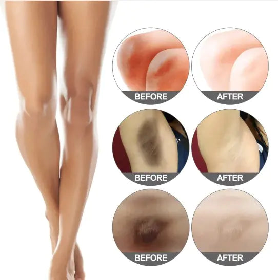 Brightening Elbow & Knee Exfoliator