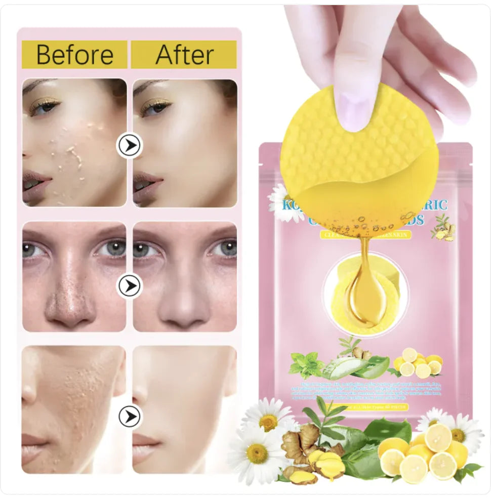 Turmeric & Kojic Acid Oil Control Pads